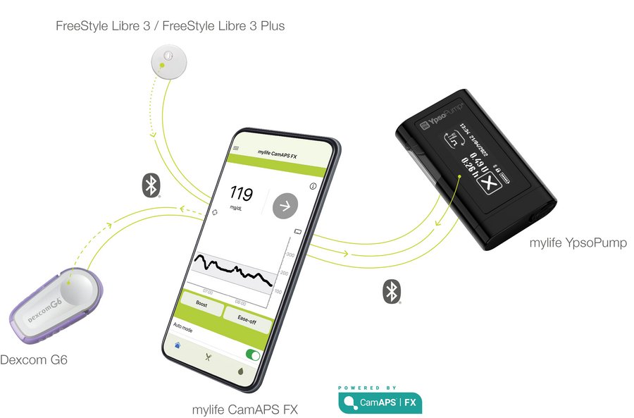Mehr Freiheit im Alltag für Menschen mit Typ-1-Diabetes